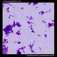 corynebacterium pseudotuberculosis microscopy
